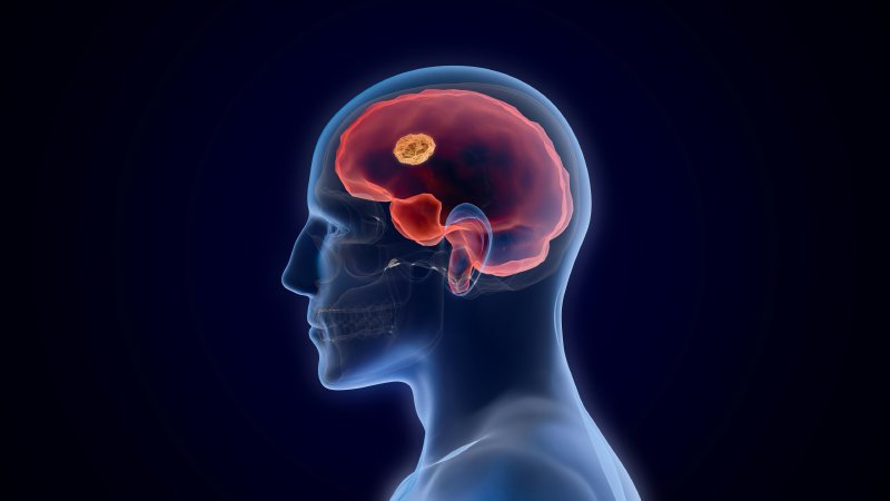 Why Learning a Language Changes Your Brain